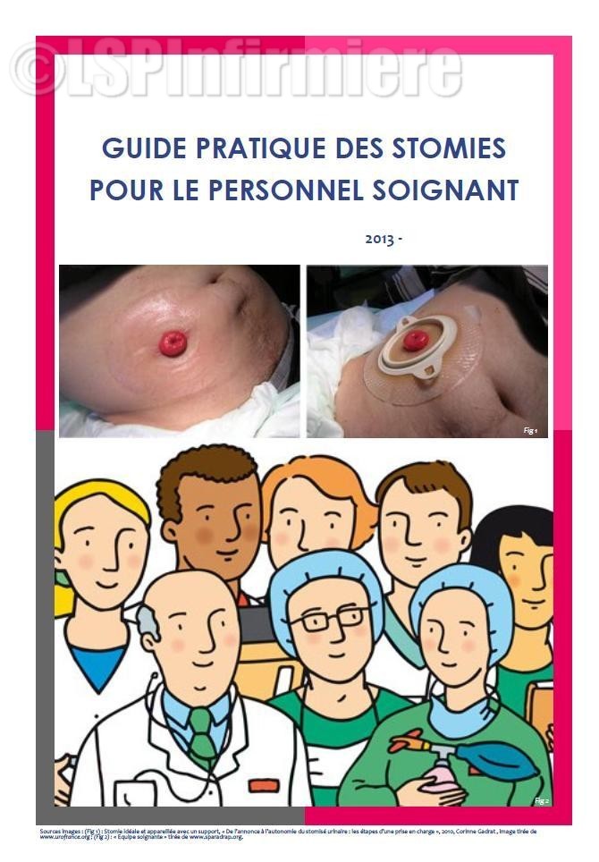 Guide pratique des stomies