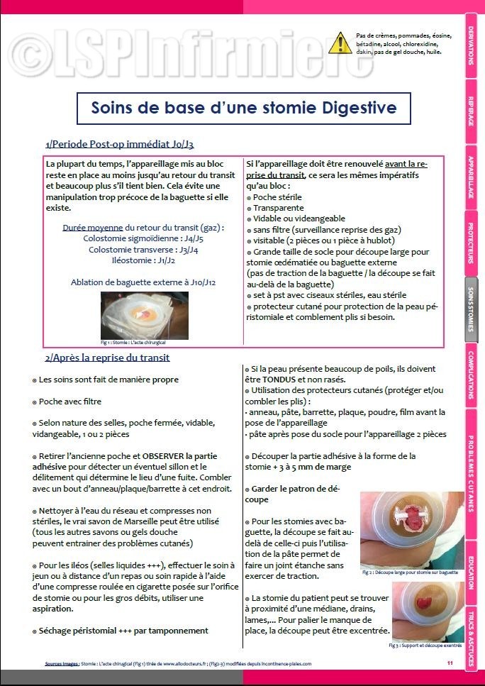 Soins de base stomie digestive