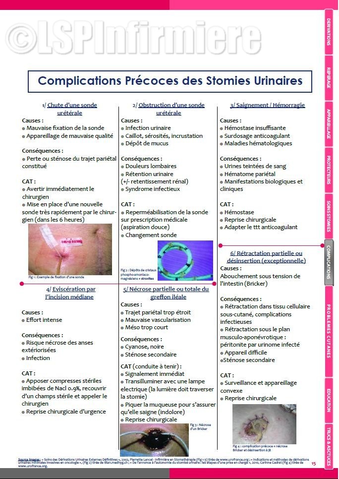 Complications précoces stomies urinaires