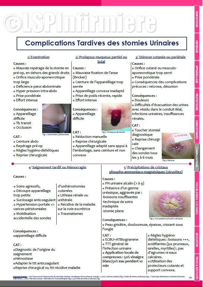 Complications tardives stomies urinaires