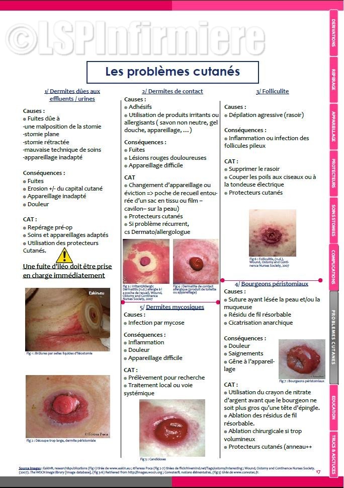 Problèmes cutanés