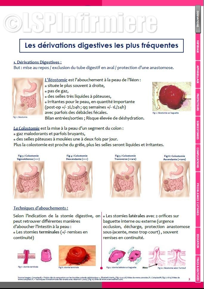 Les derivations digestives