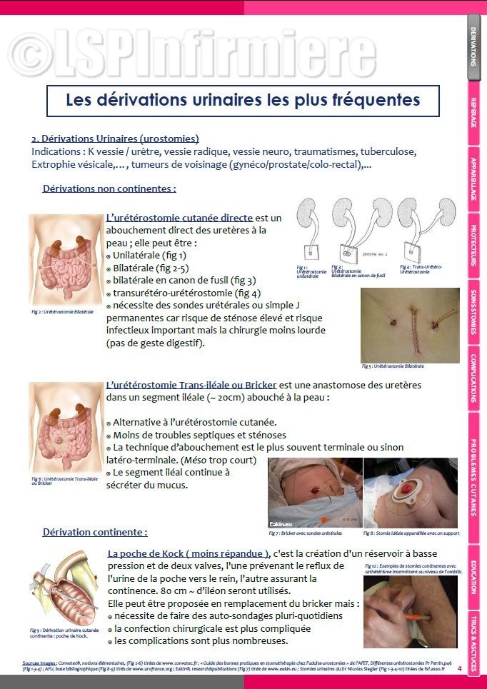 Les dérivations urinaires