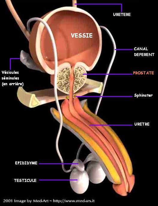 traitement adenome prostate